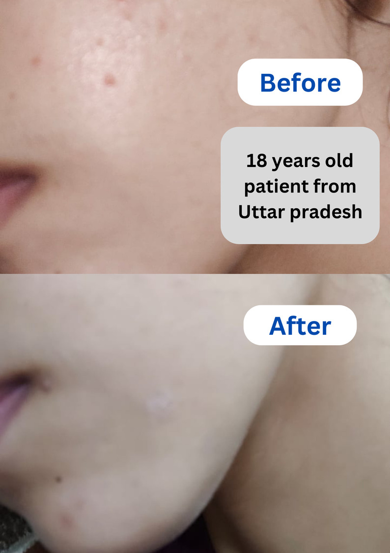 Best Dermatologist in Lucknow- Dr Dev's Skin Clinic